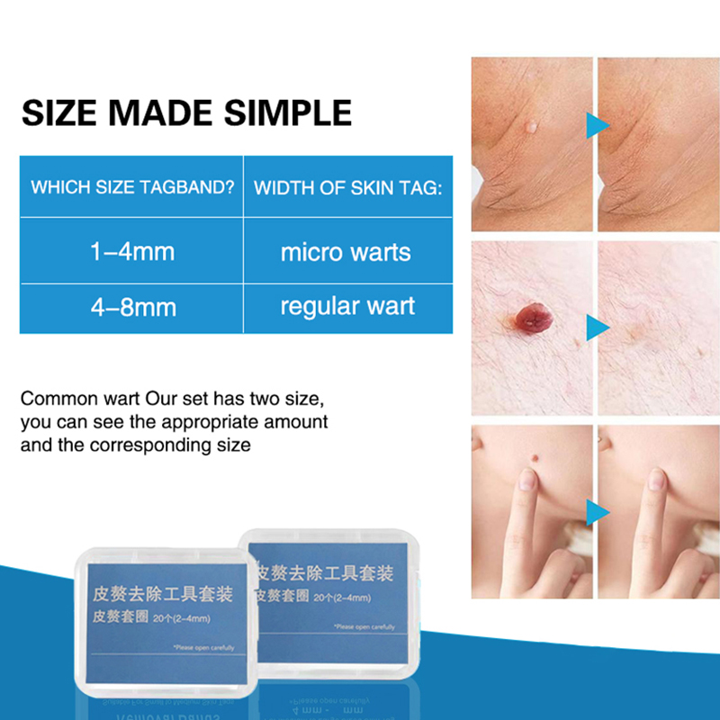 20pcs/Box Flesh Nevus Removal  - đánh giá và giá Kit Power Tools